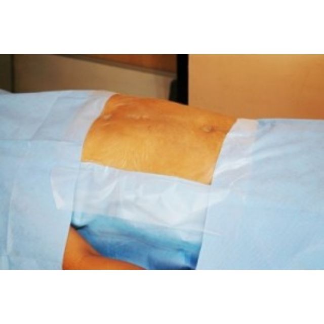 Surgiwear Incise Drape - Global Surgicals