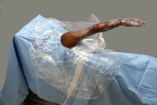 Surgiwear Shoulder Arthroscopy Drape - Global Surgicals