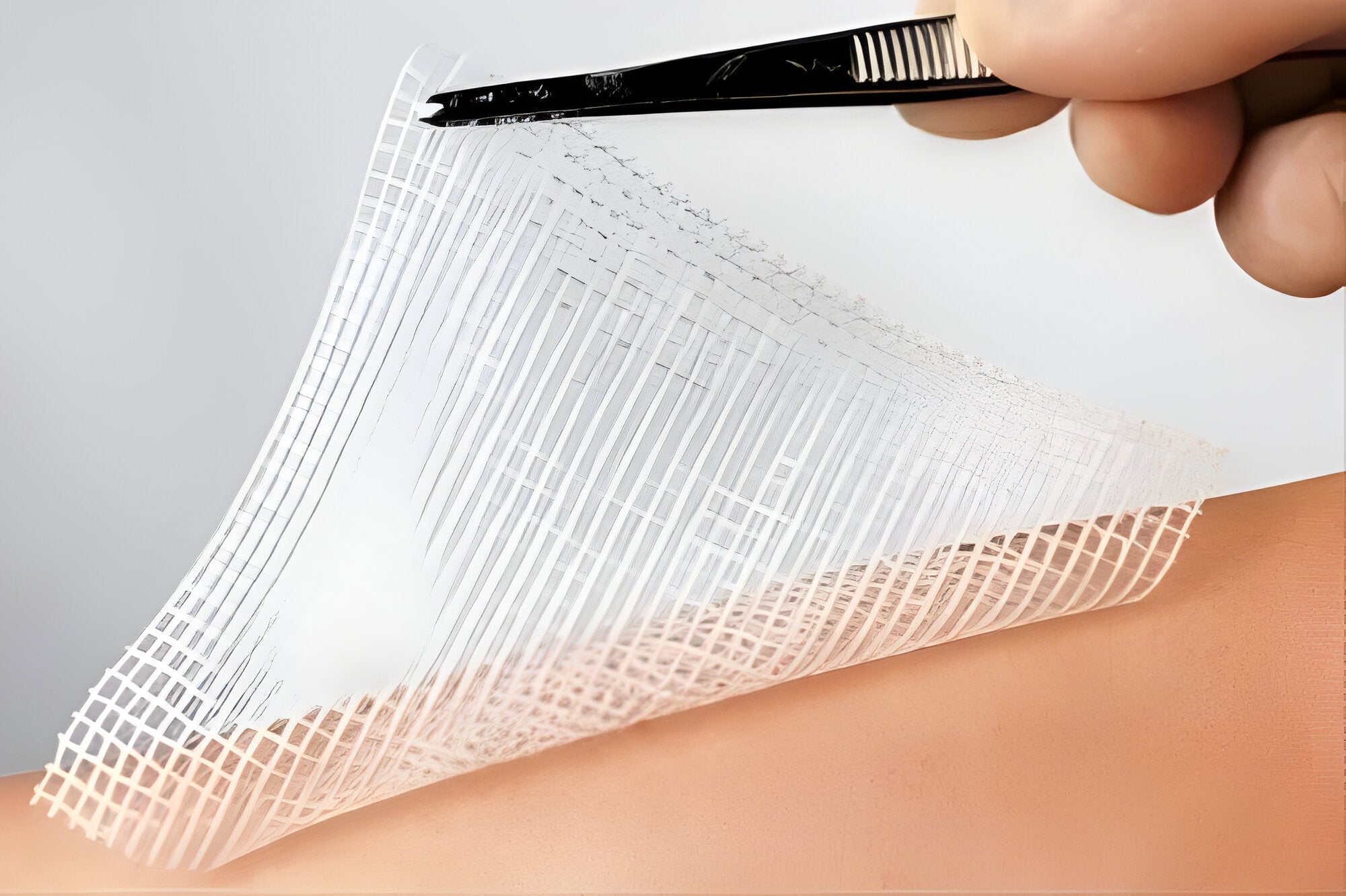 TecHeal Bactitulle Chlorhexidine Dressing Guaze - Global Surgicals