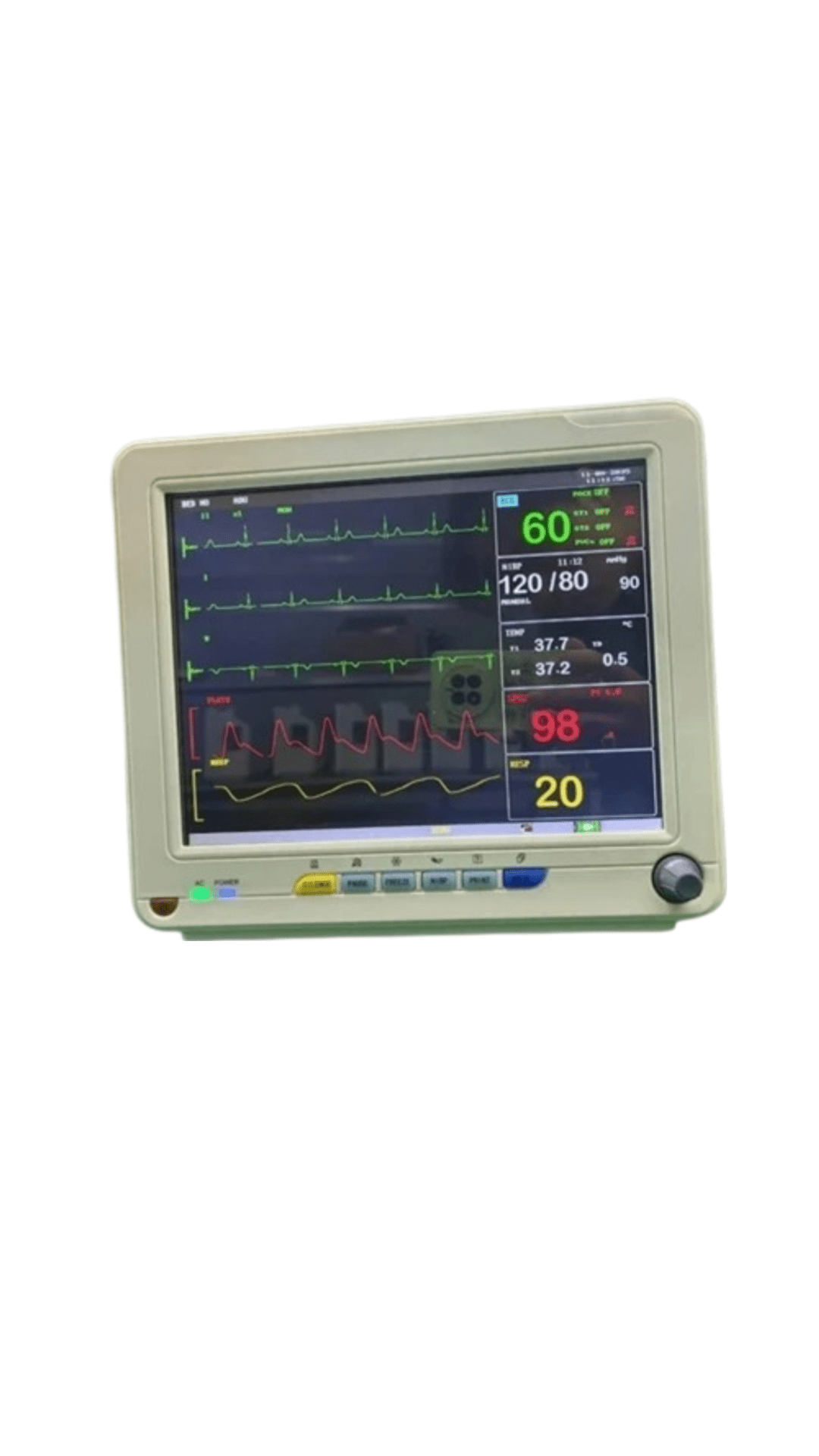 Technocare Multipara Monitor 12.1Inch - Global Surgicals