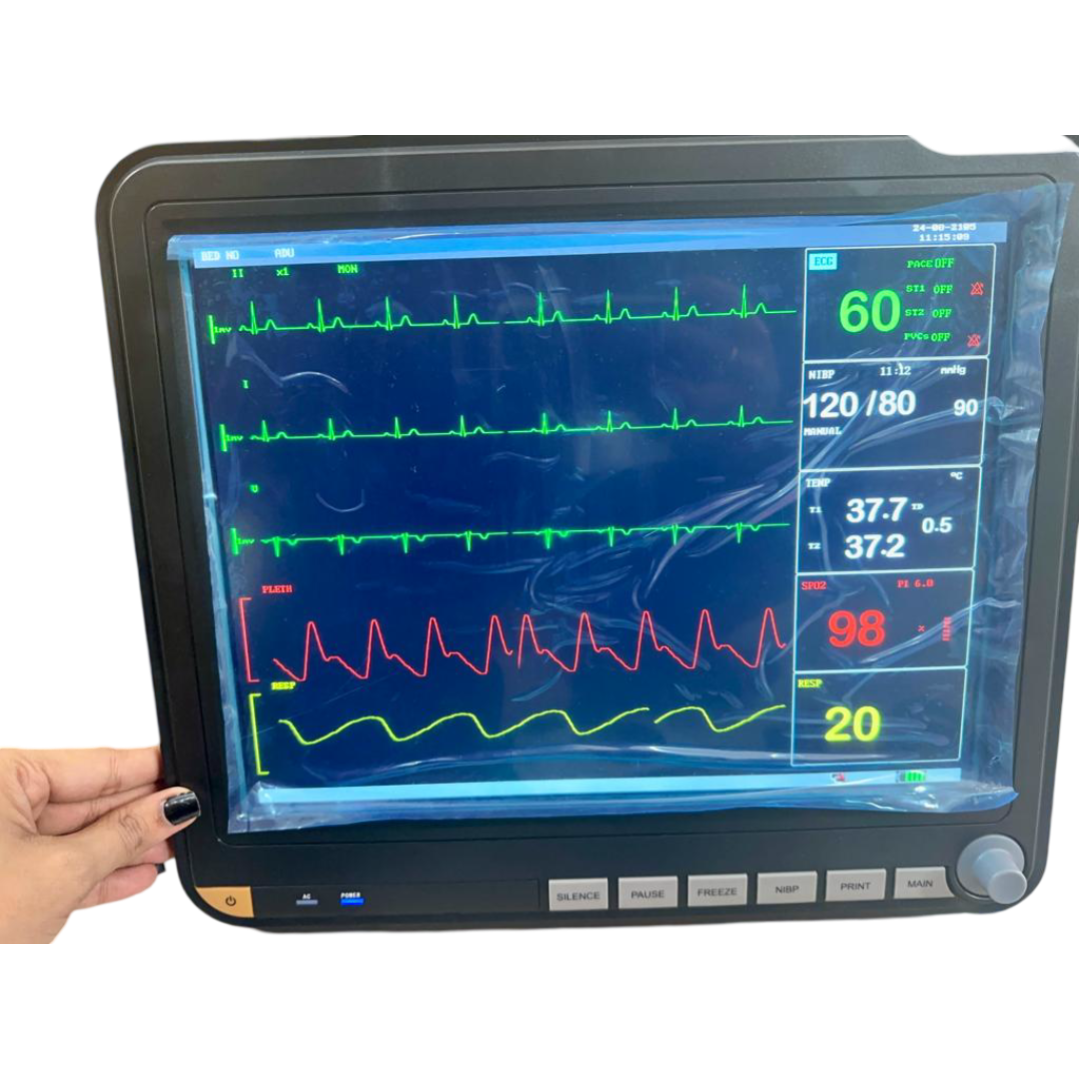 Technocare Multipara Patient Monitor - Global Surgicals