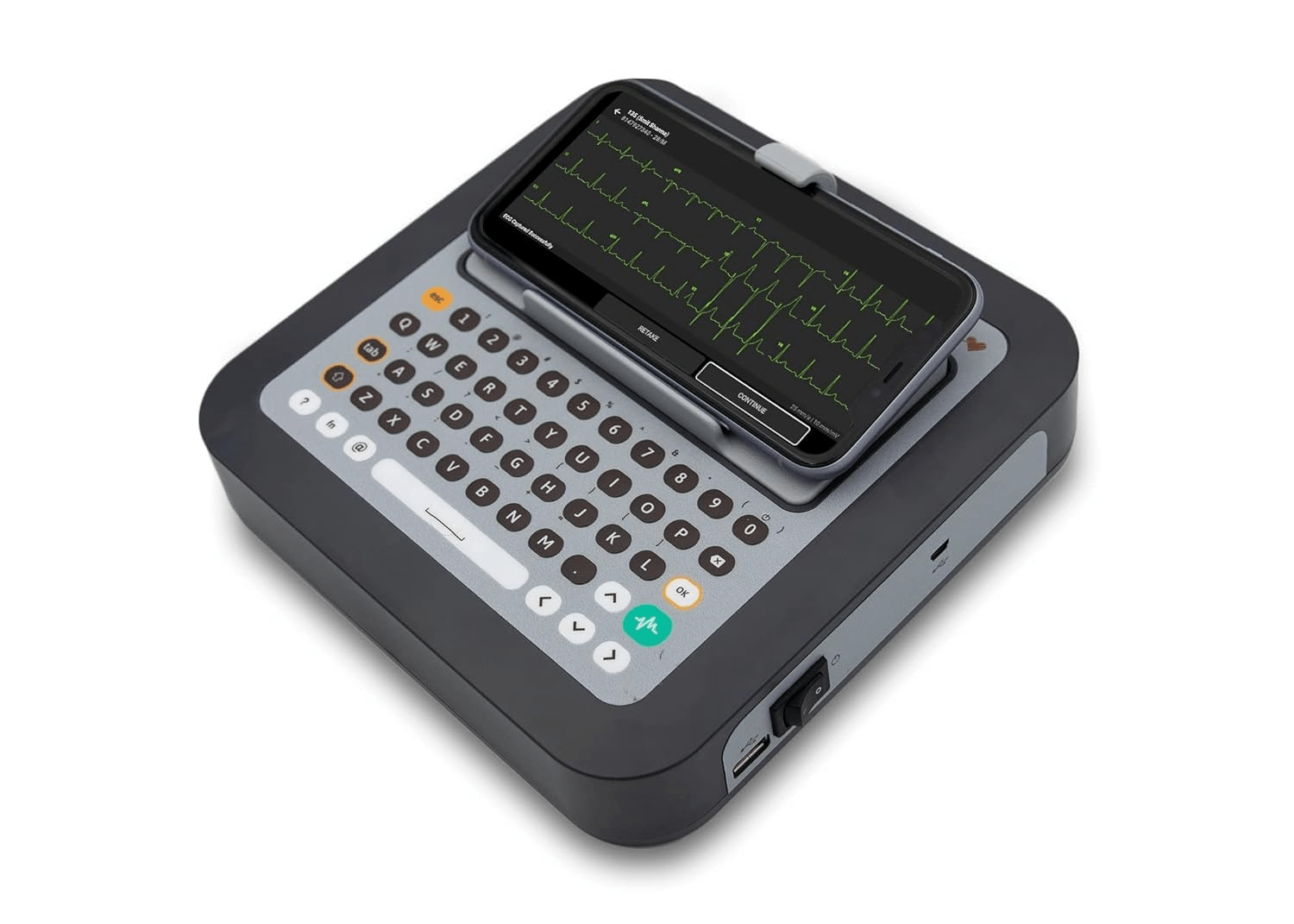 Tricog VCardia InstaECG Twelve Channel ECG Machine - VCardia Advanced - Global Surgicals