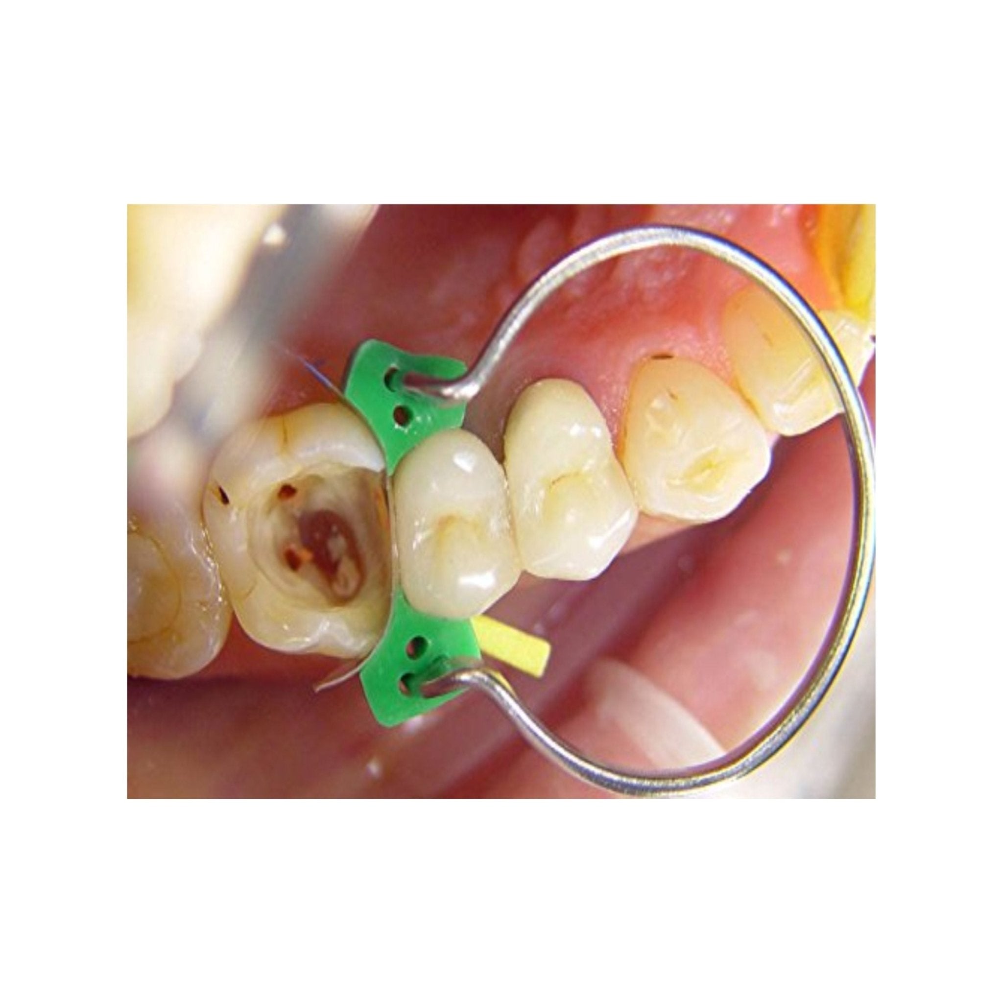 Trust & Care Tor M Sectional - Global Surgicals