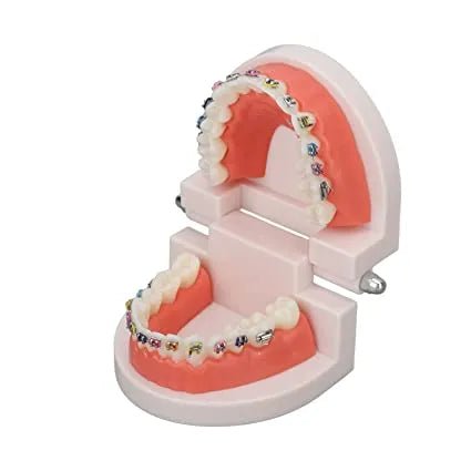 Unique Dents Ortho Patient Education Model - Global Surgicals