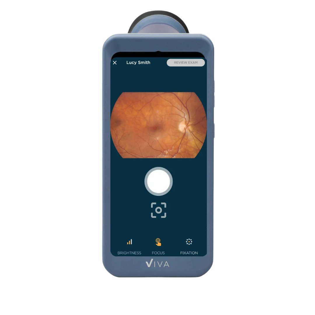 Volk Viva Fundus Camera