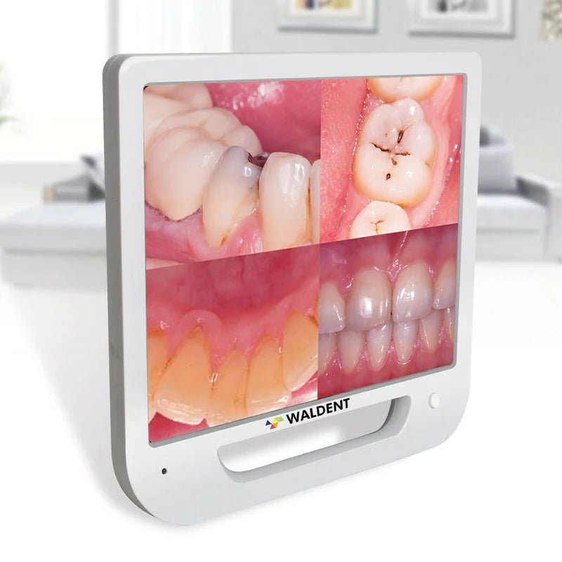 Waldent Ergo 10 MP With Screen Intra Oral Camera - Global Surgicals